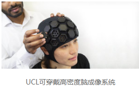UCL可穿戴高密度脑成像系统