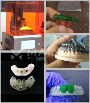宁波市DLP高精度光固化高精牙科牙模DLP通用3D打印机厂家